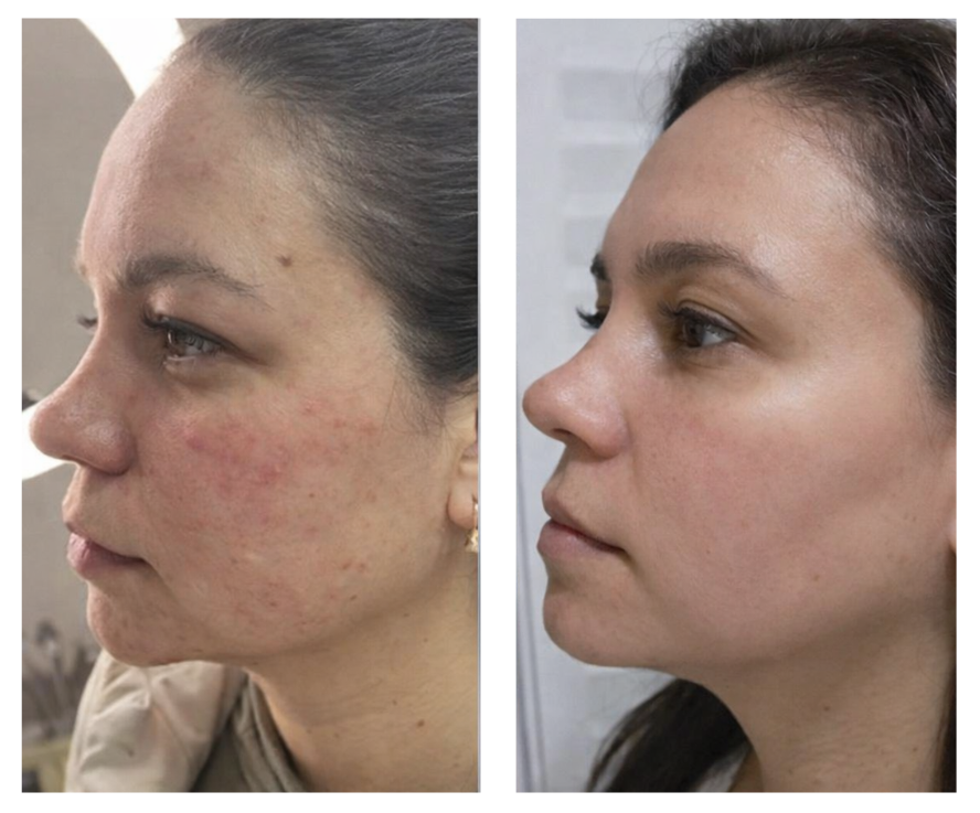 improve skin naturally