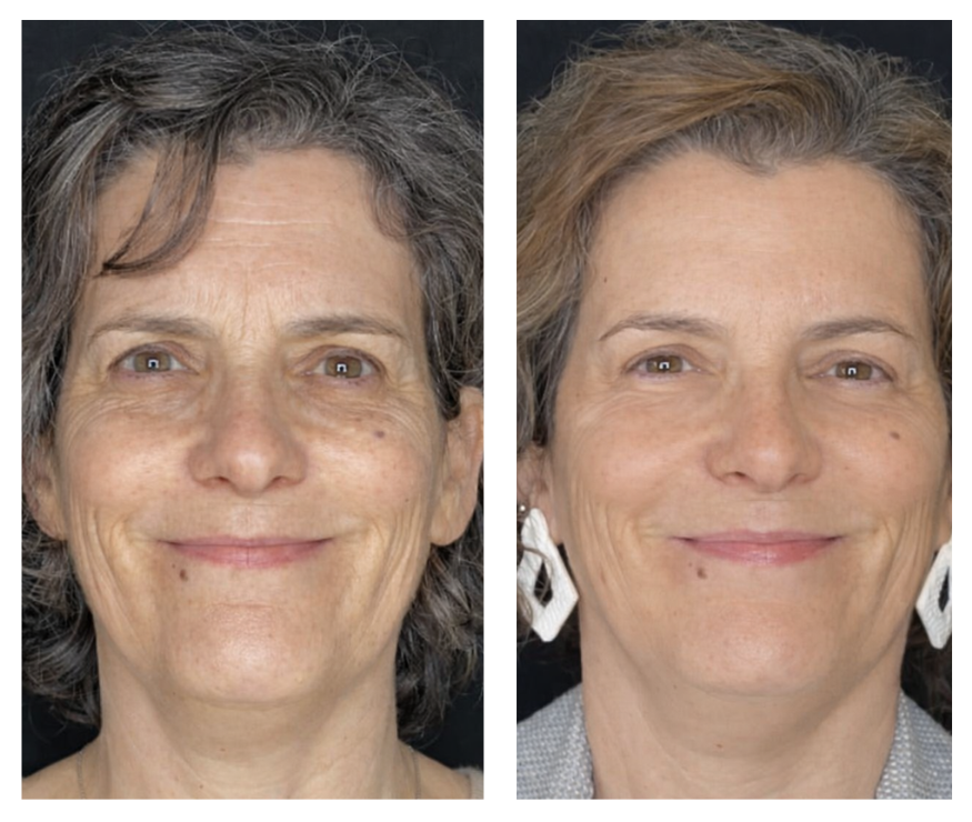 prime biome before and after