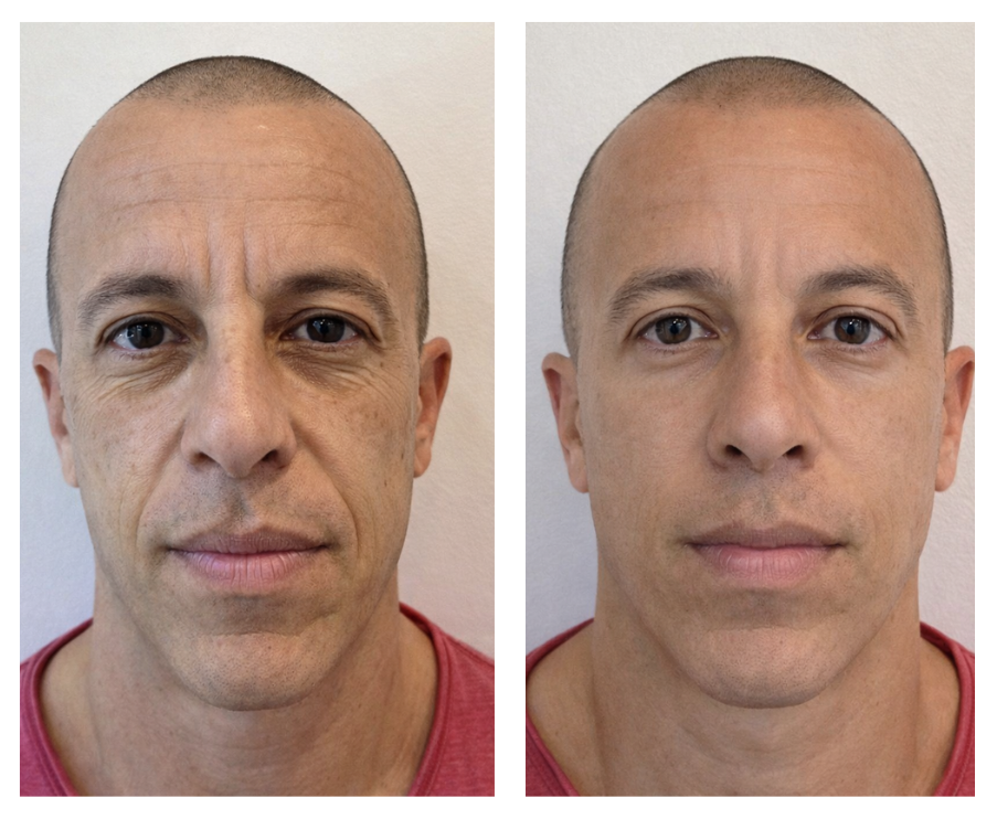 prime biome real results